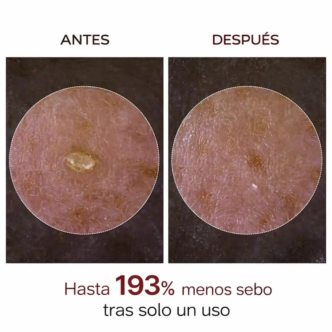 Dr. Melaxin® Peel Shot | Dúo Exfoliante Facial en Arroz Blanco y Negro para Poros Visibles